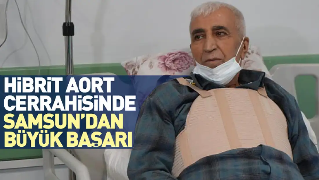 Hibrit Aort Cerrahisinde Samsun’dan Büyük Başarı