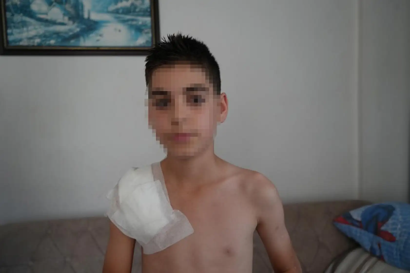 Vücudu köpek tarafından parçalanan Yunus'un hayatı karardı