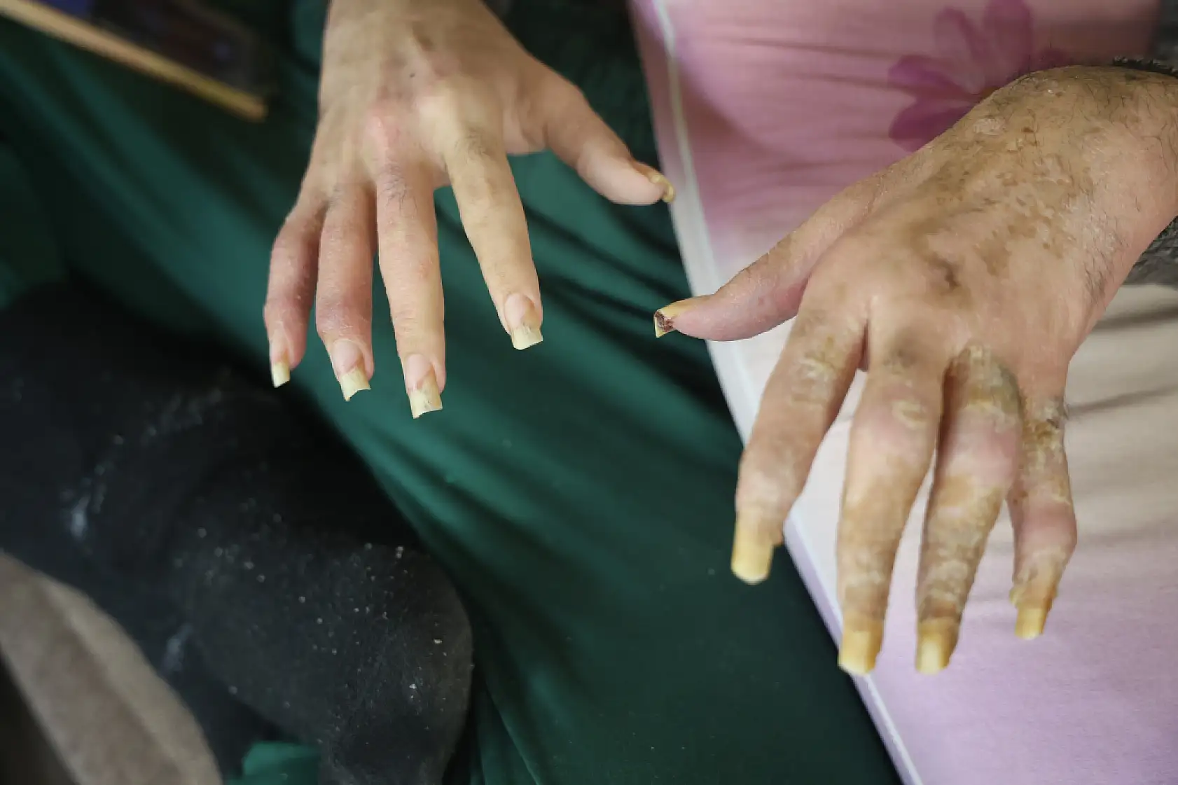 3 yıldır evden çıkmıyor