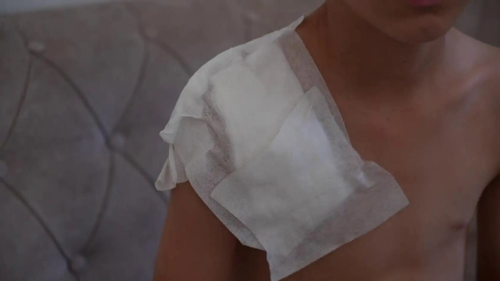 Vücudu köpek tarafından parçalanan Yunus'un hayatı karardı