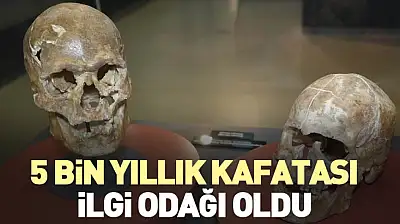 5 bin yıllık kafatası ilgi odağı oldu