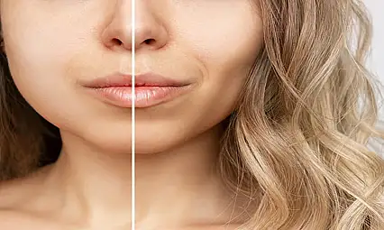 Bişektomi: Küçük Dokunuşlar Büyük Değişimler