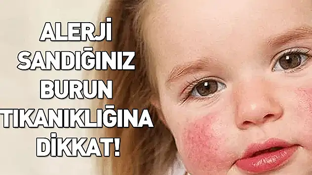 Alerji sandığınız burun tıkanıklığının nedeni kanser olabilir