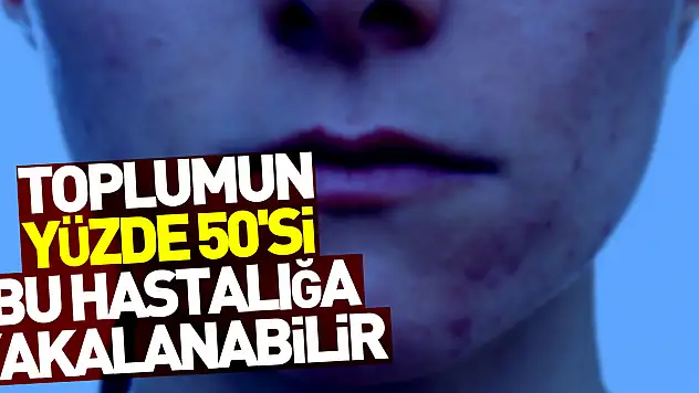 2030 yılında toplumun yüzde 50'si alerjik hasta olabilir