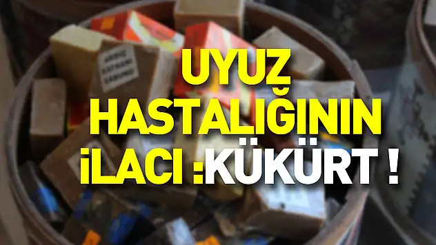 Uyuz hastalığının ilacı : Kükürt!