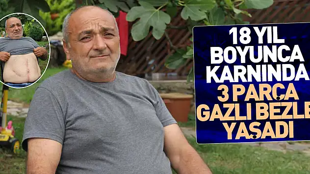 18 yıl boyunca karnında ameliyatta unutulan 3 parça gazlı bezle yaşadı