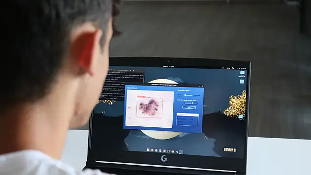 Lise öğrencisi geliştirdi, bir fotoğrafla cilt kanseri teşhis edilebilecek