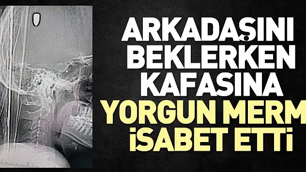 Arkadaşını beklerken kafasına yorgun mermi isabet etti