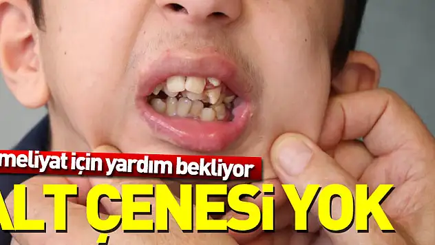 ALT ÇENESi YOK