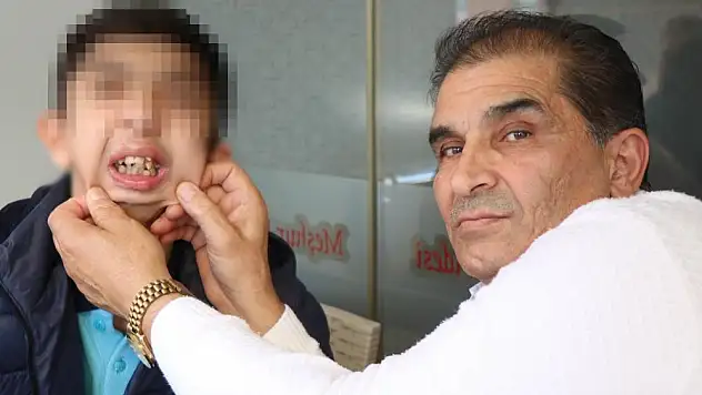 Alt çenesi yok, dişleri üst damağında