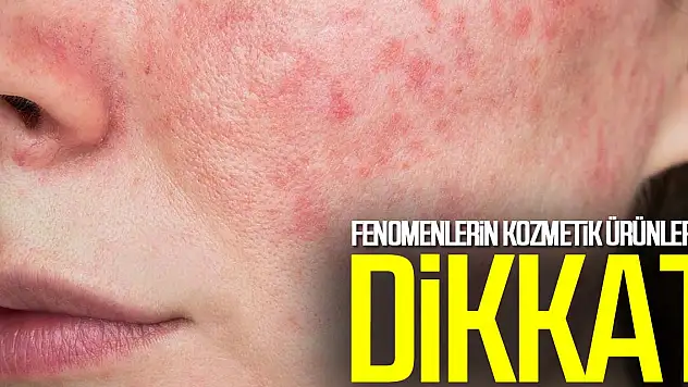 Fenomenlerin Çıkardığı Ürünlere Dikkat