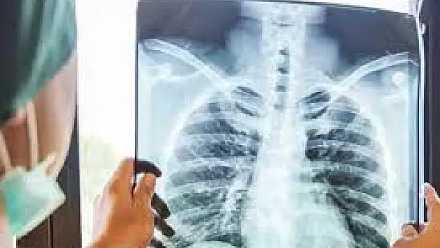 Artan zatürre vakalarına karşı uyarı: