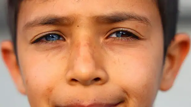 HAYATA ÇİFT RENK BAKIYOR