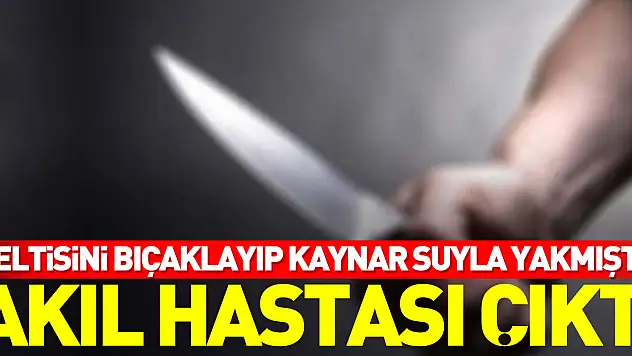 Eltisini bıçaklayıp kaynar suyla yakmıştı, akıl hastası çıktı