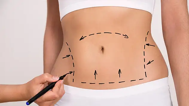 'Kilo kaybına bağlı sarkmalar, karın estetiğiyle önlenebilir'