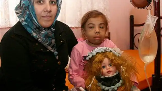 10 Yaşında Çaresiz Ölümü Bekliyor