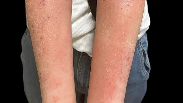 Samsun'da da yapılabiliyor