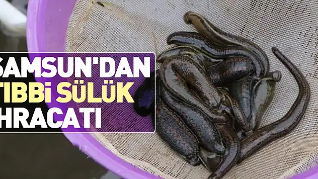 Tıbbi sülük ihracatı