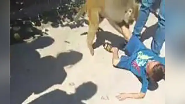 Maymun çocuğa saldırdı