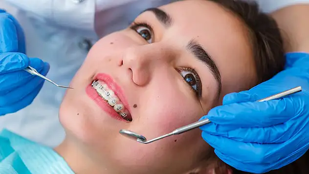 Diş Teli Tedavisi: Estetik ve Sağlıklı Gülüşün Anahtarı