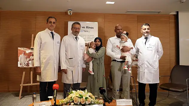 Yapışık ikizler Türkiye'de hayata tutundular