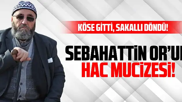 Köse gitti, sakallı döndü!