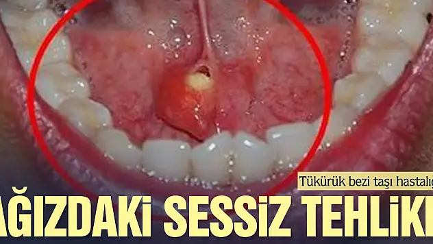 Ağızdaki sessiz tehlike