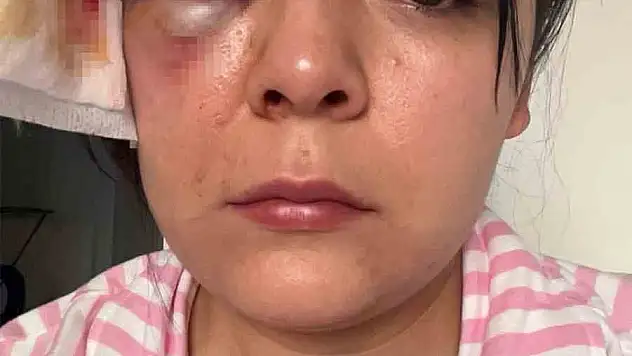 Yürürken saldırıya uğrayan genç kız konuştu: 'Psikolojim altüst oldu'