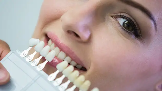 Lamine Diş Kaplama Kimler İçin Uygundur?