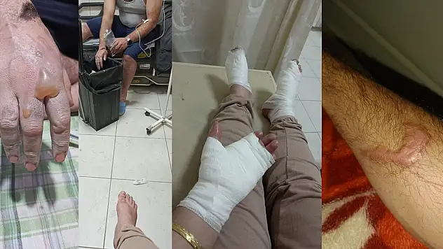 Lavabo açıcı patladı