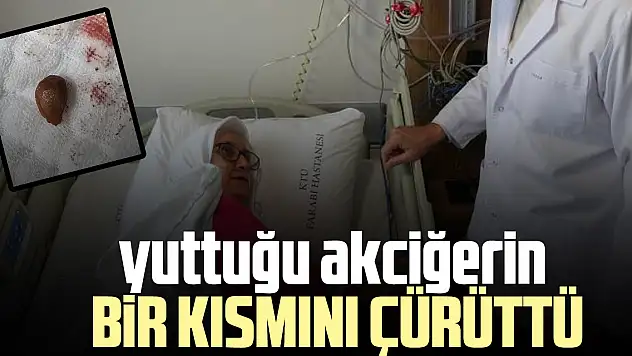 Yuttuğu akciğerin bir kısmını çürüttü