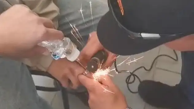 Parmağına yüzük sıkıştı, itfaiye seferber oldu