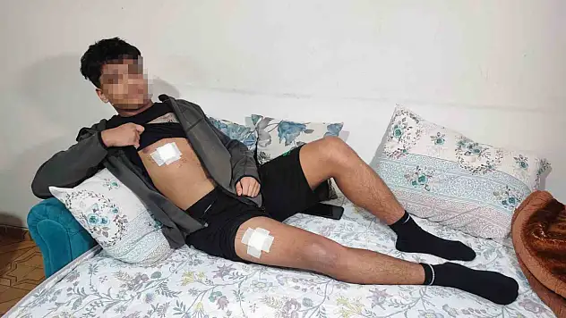 15 Yaşındaki Çocuk Akran Zorbalığı Kurbanı