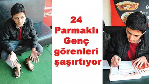 24 Parmaklı Genç görenleri şaşırtıyor