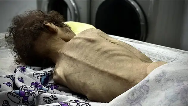 24 saatte 4 kişi daha açlıktan hayatını kaybetti