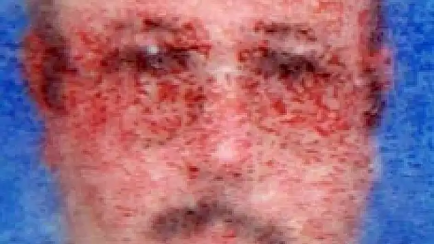  AMBULANSIN ÇARPTIĞI BİSİKLETLİ ÖLDÜ