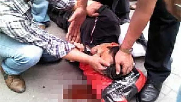 Sokak Ortasında Saldırıya Uğradı