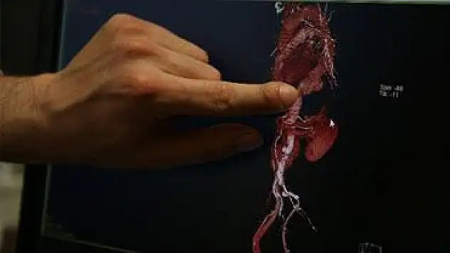 Aynı anda iki ameliyat