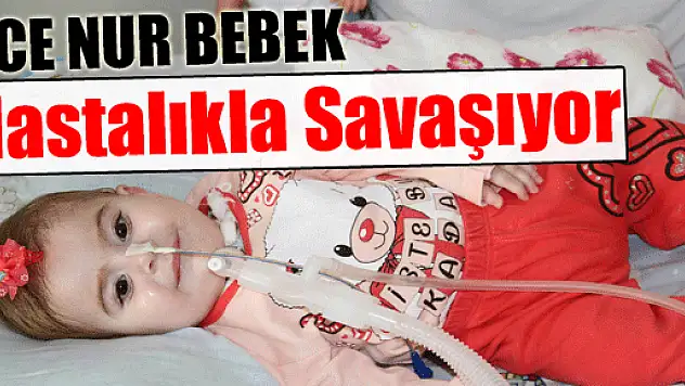 Ece Nur Bebek Hastalıkla Savaşıyor
