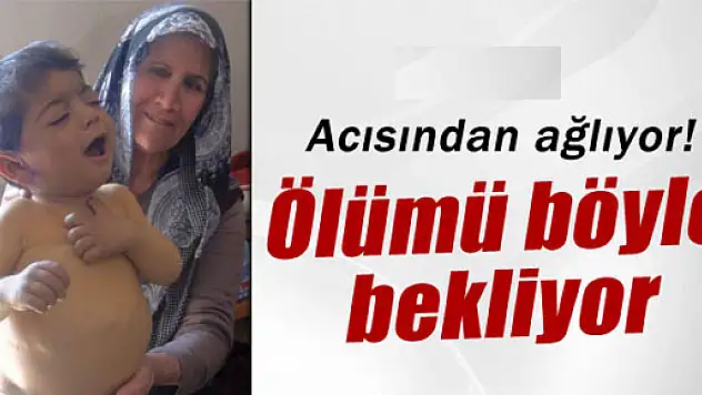 Minik Erdem karaciğer nakli yapılmazsa ölecek