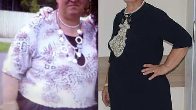 Sağlıklı Beslenerek 50 Kilo Zayıfladı 
