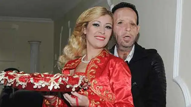 Beşinci yüz nakilli Recep Sert baba oluyor