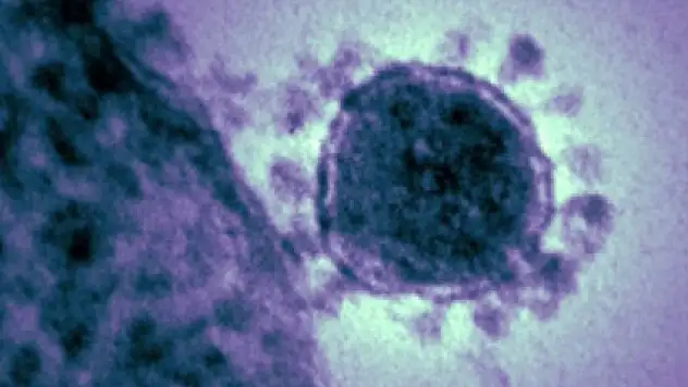 Güney Kore'de MERS virüsü 19 hayata mal oldu