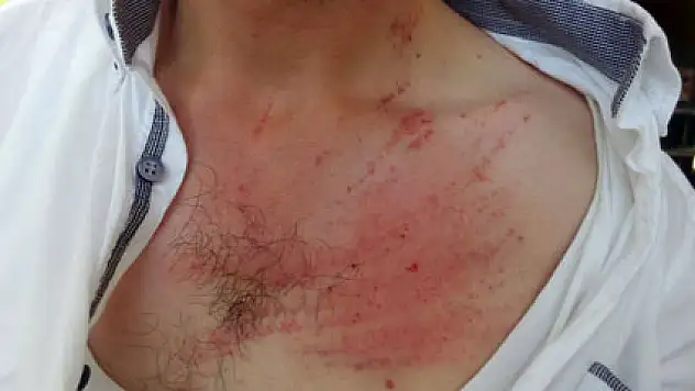 Emniyet amiri polisi dövdü iddiası