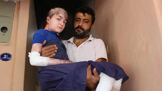 Vücudu eriyen Gamze asansör istiyor