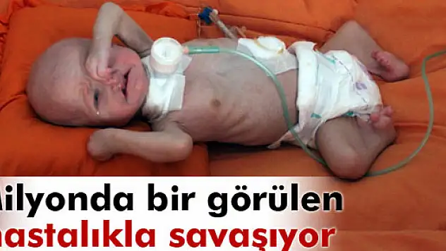 Minik Mustafa milyonda bir görülen hastalıkla savaşıyor