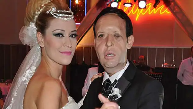 Yüz nakli olan Recep Sert, kız babası olacak