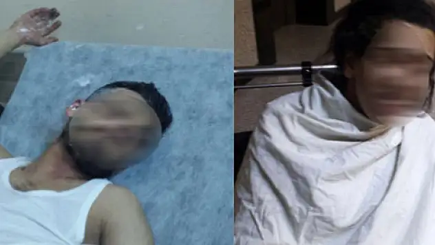 Araç kundaklarken kendini ve sevgilisini yaktı