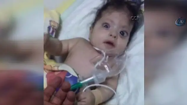 Domuz gribi teşhisi konulan bebek başka bebeklerle aynı yatakta