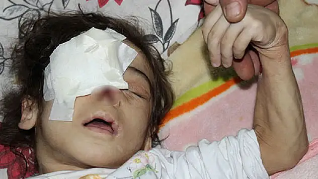 4 yaşındaki Selen kendisine zarar vermesin diye yatağa bağlanıyor
